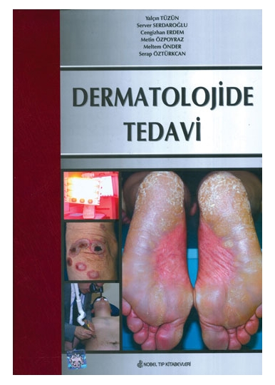 Dermatolojide Tedavi