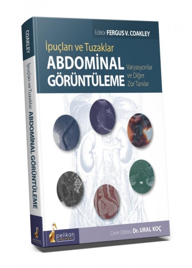 İpuçları ve Tuzaklar Abdominal Görüntüleme Varyasyonlar ve Diğer Zor Tanılar