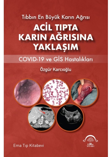 Acil Tıpta Karın Ağrısına Yaklaşım