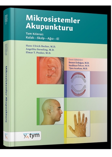 Mikrosistemler Akupunkturu