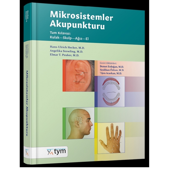 Mikrosistemler Akupunkturu