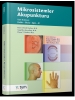 Mikrosistemler Akupunkturu