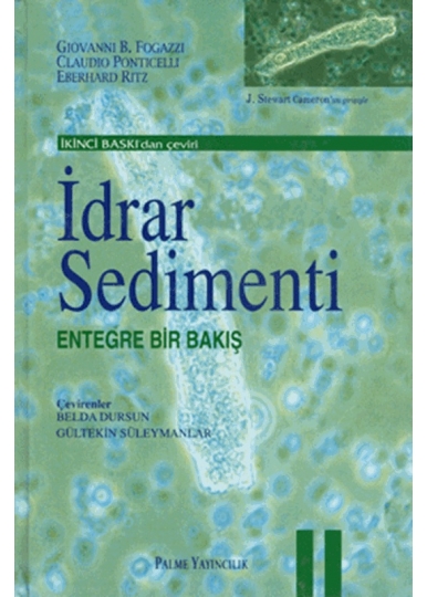 İdrar Sedimenti