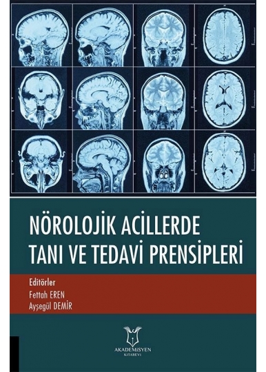 Nörolojik Acillerde Tanı ve Tedavi Prensipleri