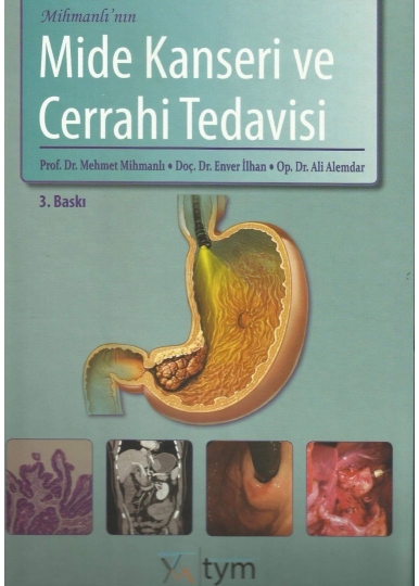 Mihmanlı'nın Mide Kanseri ve Cerrahi Tedavisi