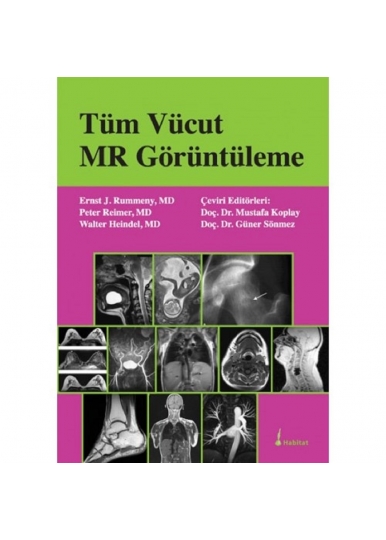 Tüm Vücut MR Görüntüleme