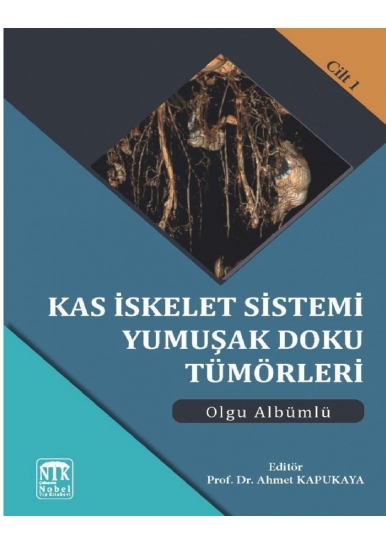 Kas İskelet Sistemi Yumuşak Doku Tümörleri Olgu Albümlü Cilt 1