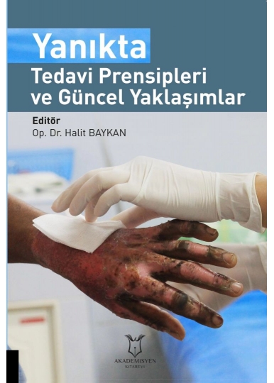 Yanıkta Tedavi Prensipleri ve Güncel Yaklaşımlar