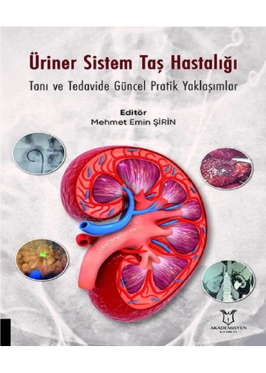 Üriner Sistem Taş Hastalığı: Tanı ve Tedavide Güncel Pratik Yaklaşımlar