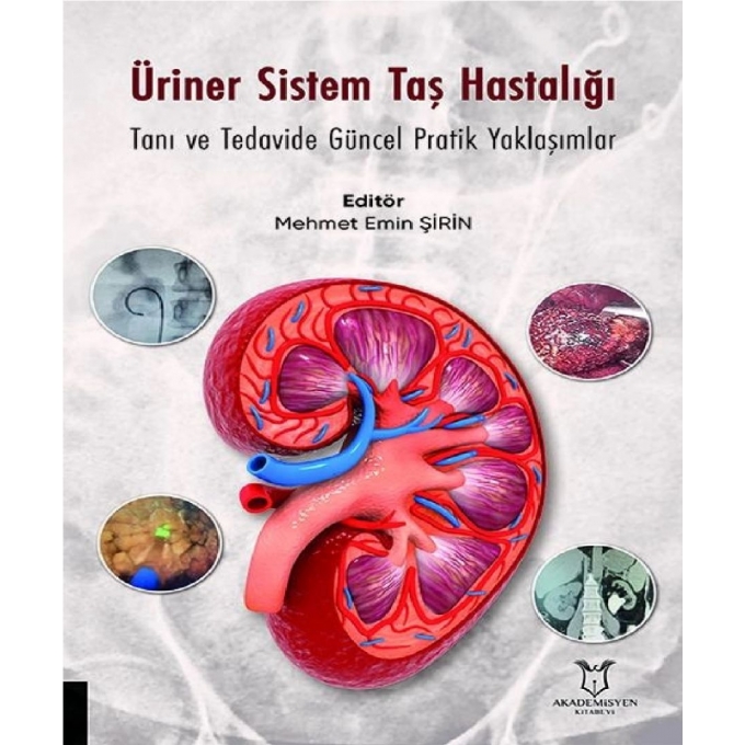 Üriner Sistem Taş Hastalığı: Tanı ve Tedavide Güncel Pratik Yaklaşımlar
