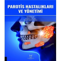 Parotis Hastalıkları ve Yönetimi