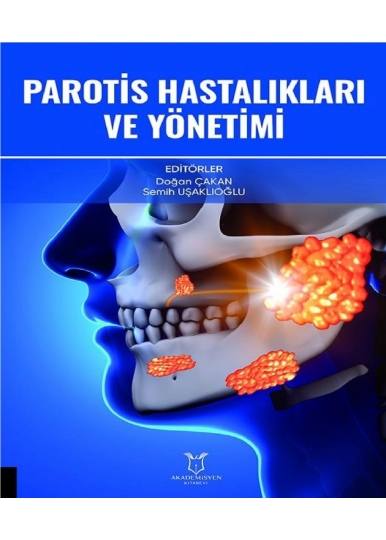 Parotis Hastalıkları ve Yönetimi