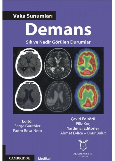 Demans - Vaka Sunumları - Sık ve Nadir Görülen Durumlar