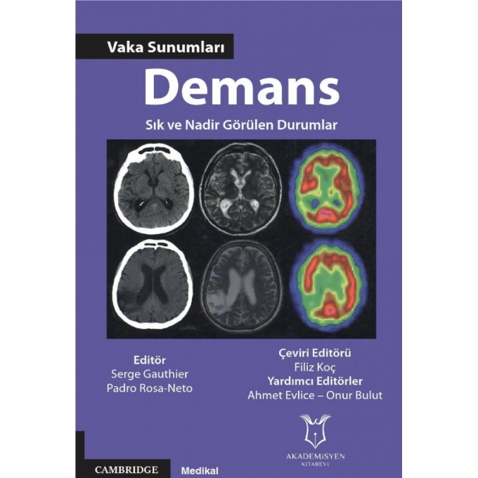 Demans - Vaka Sunumları - Sık ve Nadir Görülen Durumlar