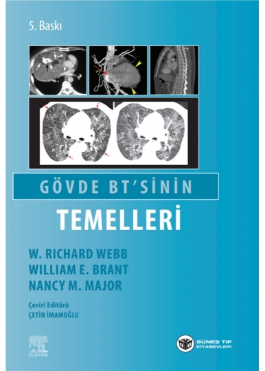 Gövde BT'sinin Temelleri
