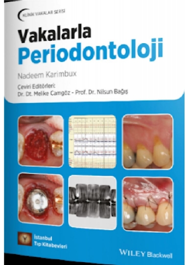 Klinik Vakalar Serisi Vakalarla Periodontoloji                                           