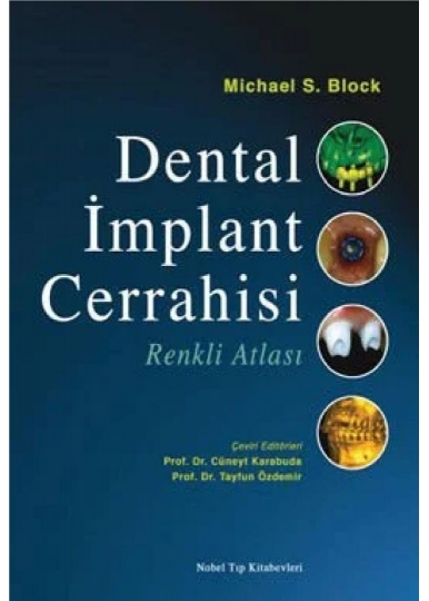 Dental İmplant Cerrahisi Renkli Atlası