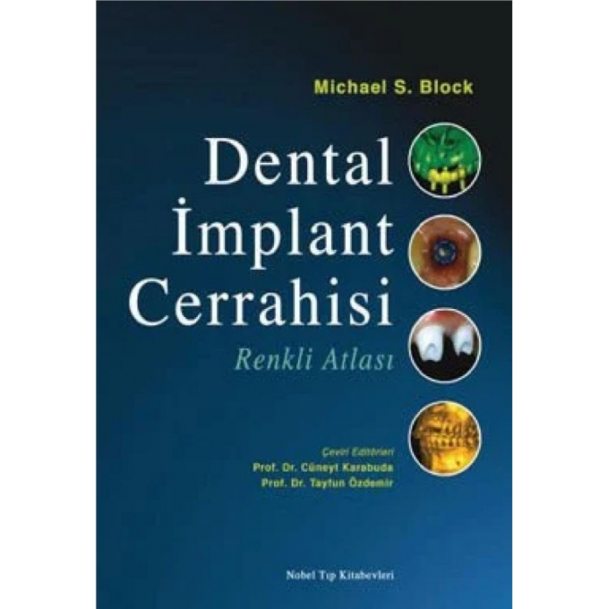 Dental İmplant Cerrahisi Renkli Atlası