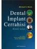 Dental İmplant Cerrahisi Renkli Atlası