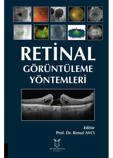 Retinal Görüntüleme Yöntemleri