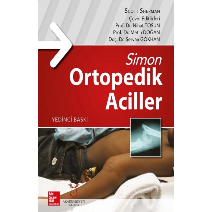 Simon Ortopedik Aciller