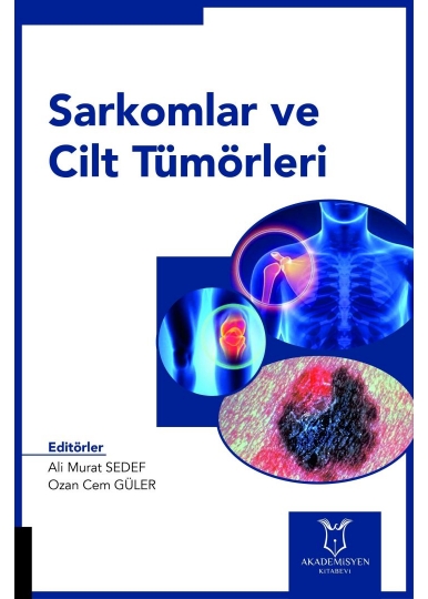 Sarkomlar ve Cilt Tümörleri