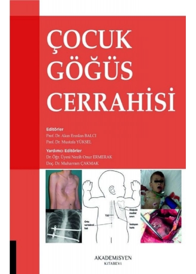 Çocuk Göğüs Cerrahisi