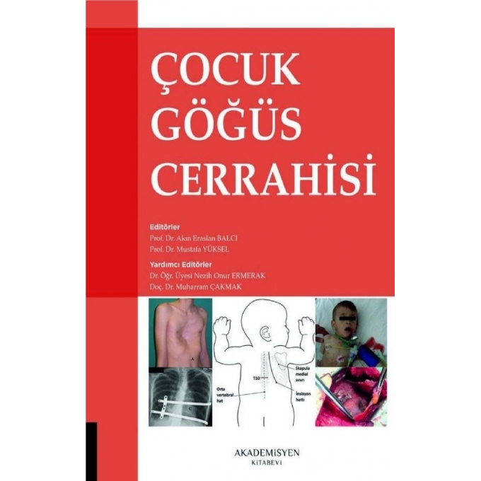 Çocuk Göğüs Cerrahisi