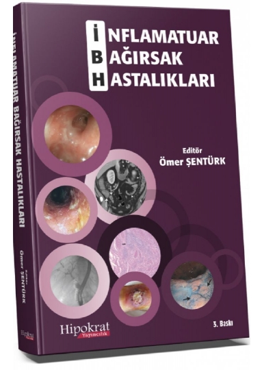 İnflamatuar Bağırsak Hastalıkları
