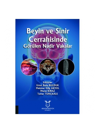 Beyin ve Sinir Cerrahisinde Görülen Nadir Vakalar
