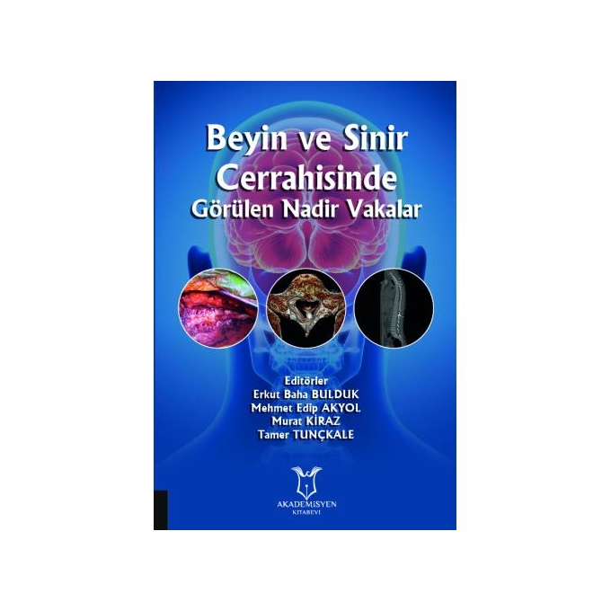 Beyin ve Sinir Cerrahisinde Görülen Nadir Vakalar