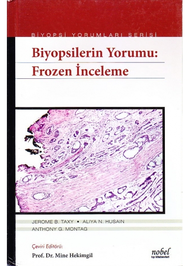 Biyopsilerin Yorumu: Frozen İnceleme