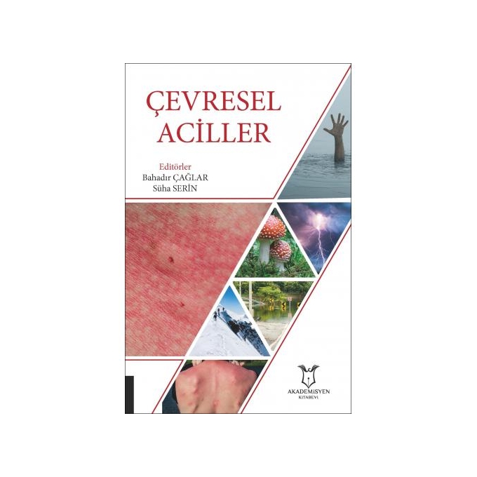 Çevresel Aciller