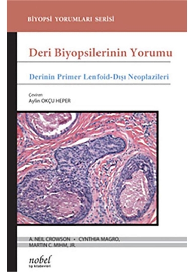 Deri Biyopsilerinin Yorumu: Derinin Primer Lenfoid-Dışı Neoplazileri