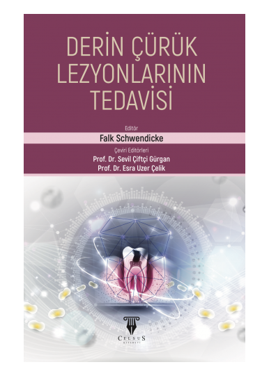 Derin Çürük Lezyonlarının Tedavisi