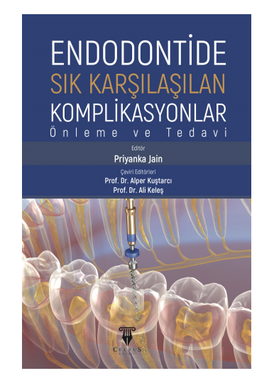 Endodontide Sık Karşılaşılan Komplikasyonlar