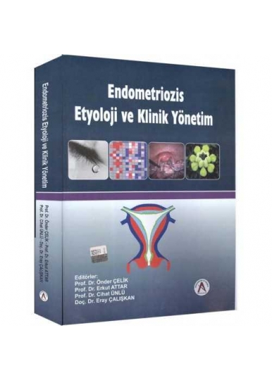 Endometriozis Etyoloji ve Klinik Yönetim