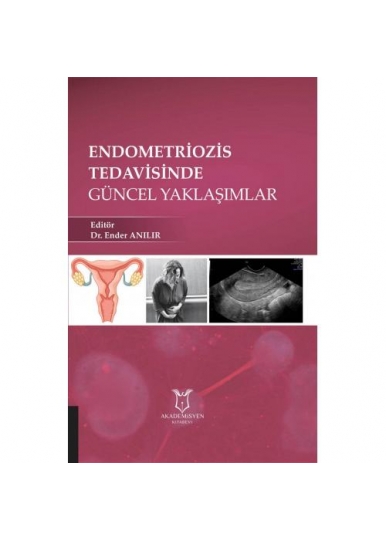 Endometriozis Tedavisinde Güncel Yaklaşımlar
