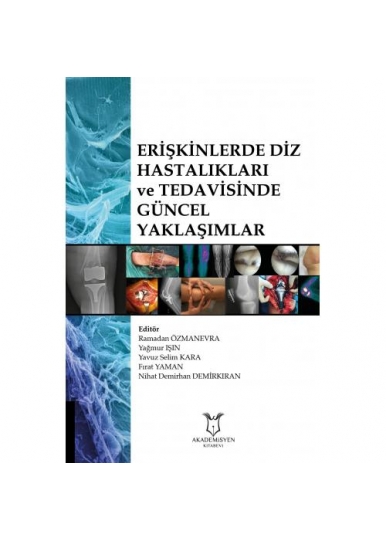 Erişkinlerde Diz Hastalıkları ve Tedavisinde GÜNCEL YAKLAŞIMLAR