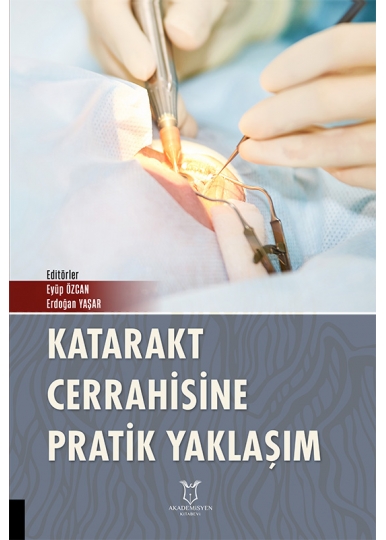 Katarakt Cerrahisine Pratik Yaklaşım