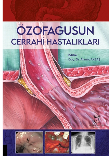 Özofagusun Cerrahi Hastalıkları