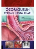 Özofagusun Cerrahi Hastalıkları