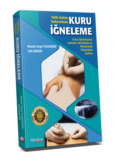 Tetik Nokta Tedavisinde Kuru İğneleme