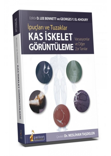 İpuçları ve Tuzaklar Kas İskelet Görüntüleme Varyasyonlar ve Diğer Zor Tanılar