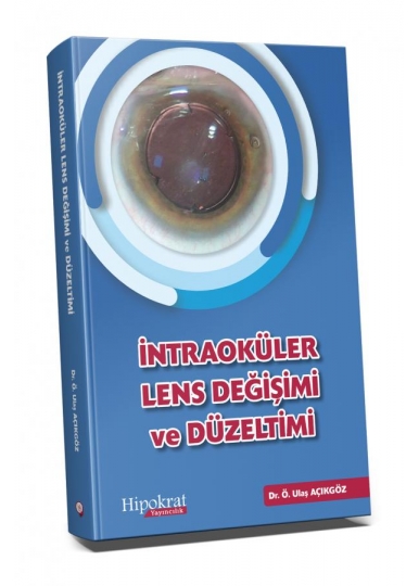 İntraoküler Lens Değişimi ve Düzeltimi
