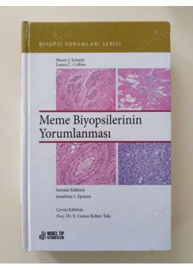 Meme Biyopsilerinin Yorumlanması