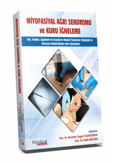 Miyofasiyal Ağrı Sendromu ve Kuru İğneleme