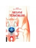 Mesane Tümörleri