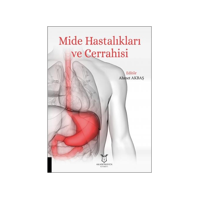 Mide Hastalıkları ve Cerrahisi
