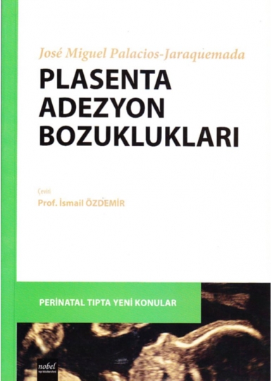 Plasenta Adezyon Bozuklukları